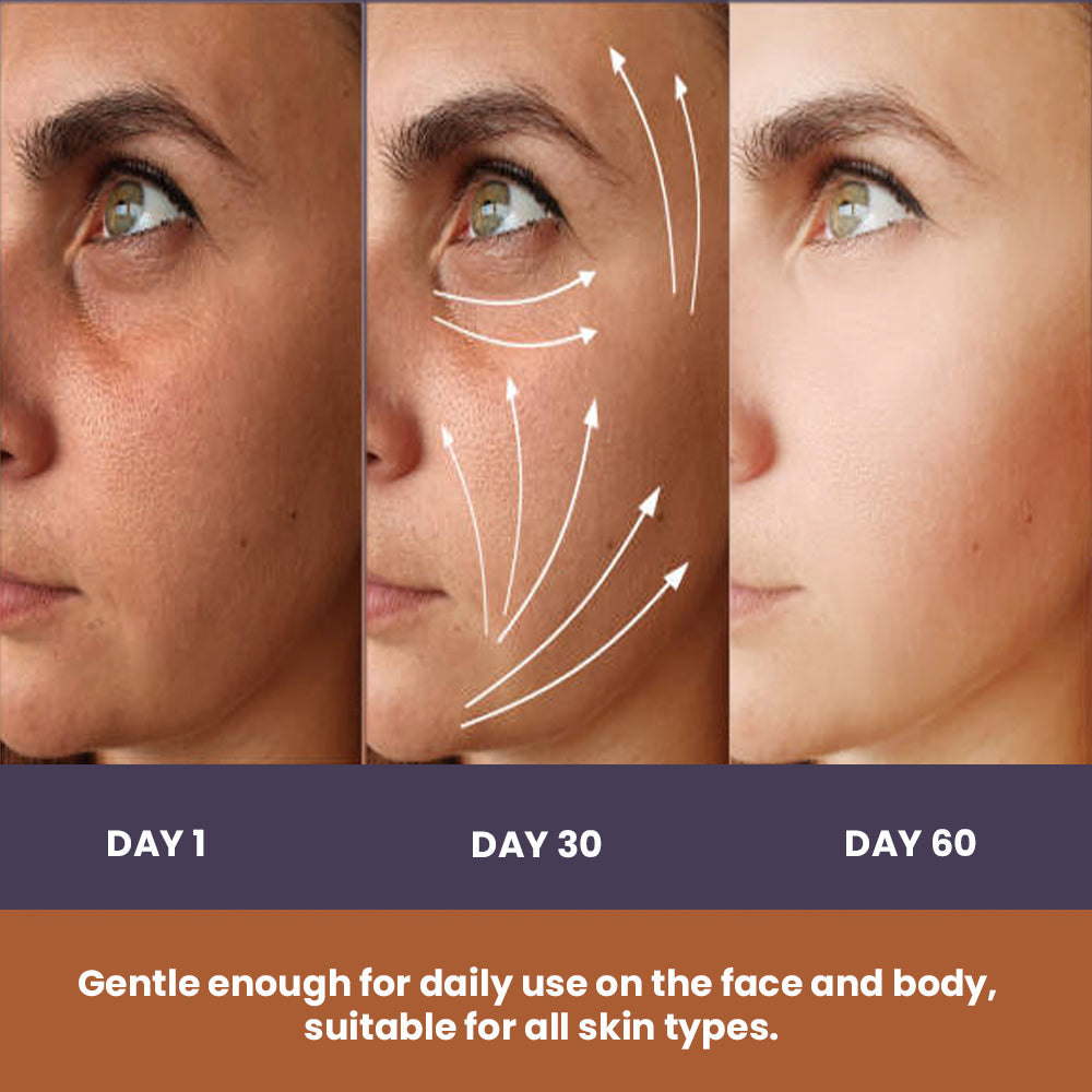 Kojic Acid++