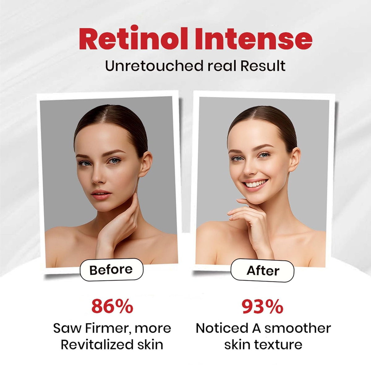 Retinol Intense Cream 0.1%