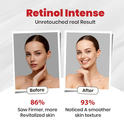 Retinol Intense Cream 0.1%